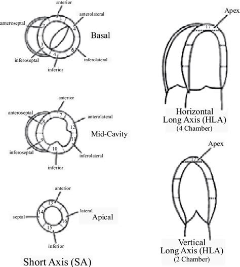 what is mild septal hypokinesis